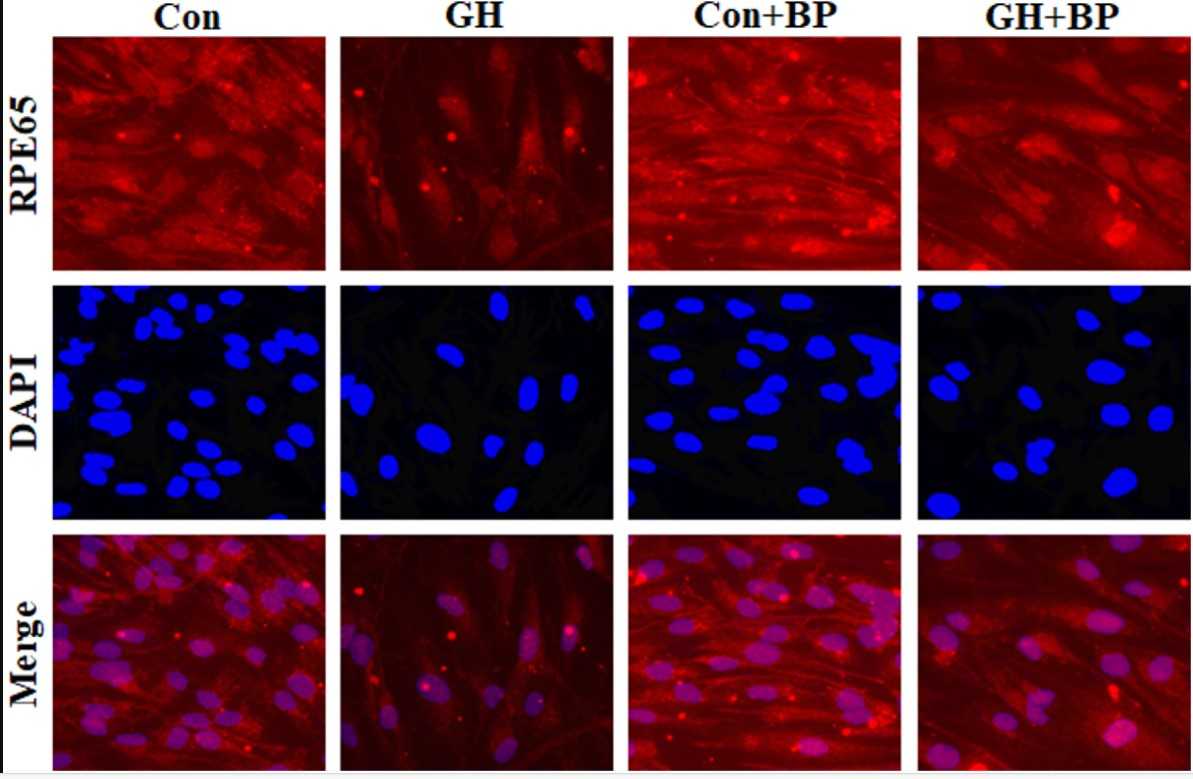 BP promoted tight junction, retinoid regeneration, and anti-angiogenesis capacity on high glucose-treated ARPE-19 cells.jpg